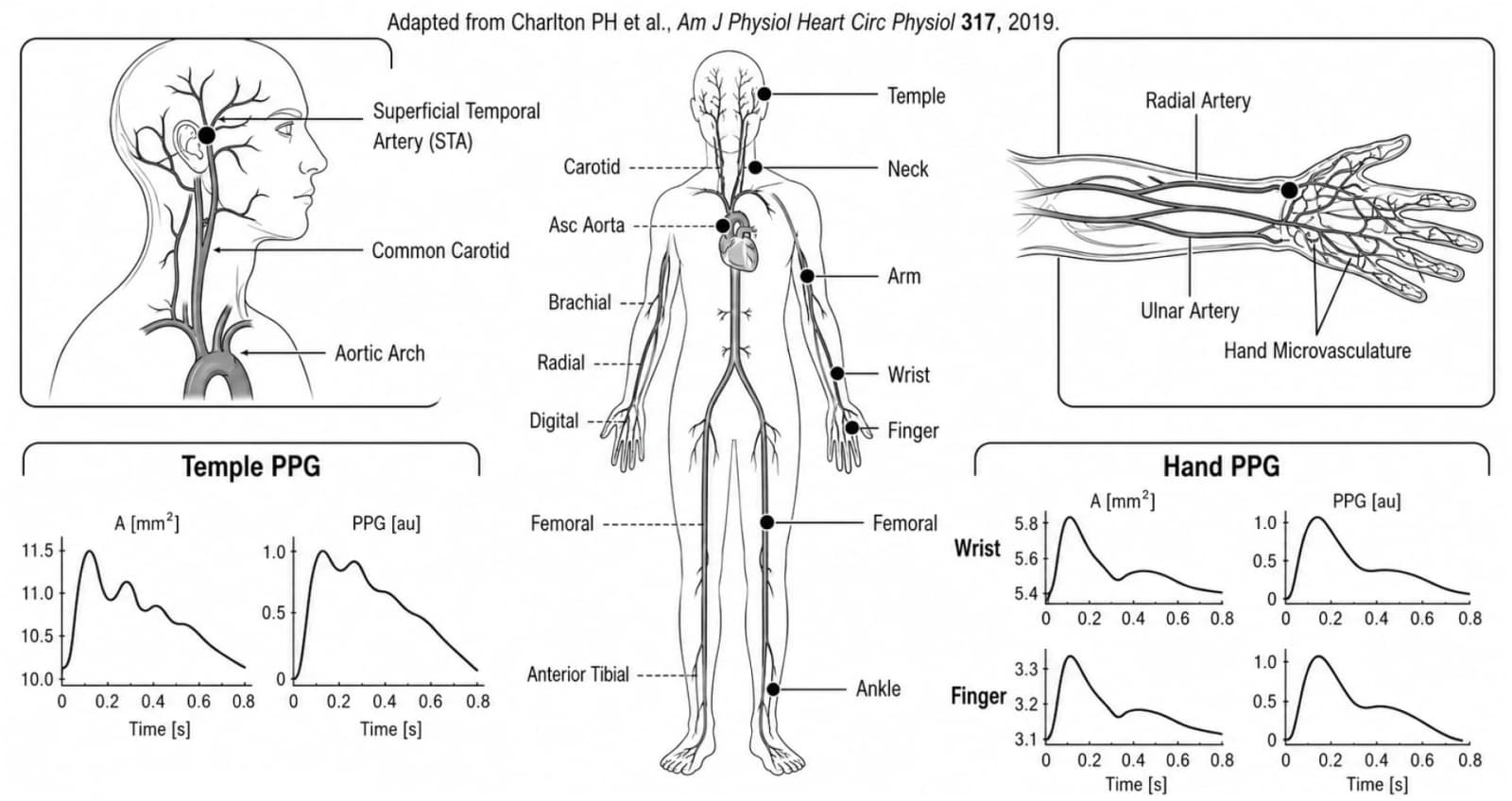 Figure 1. Anatomical and pulse-wave rationale for temple versus distal PPG measurement.