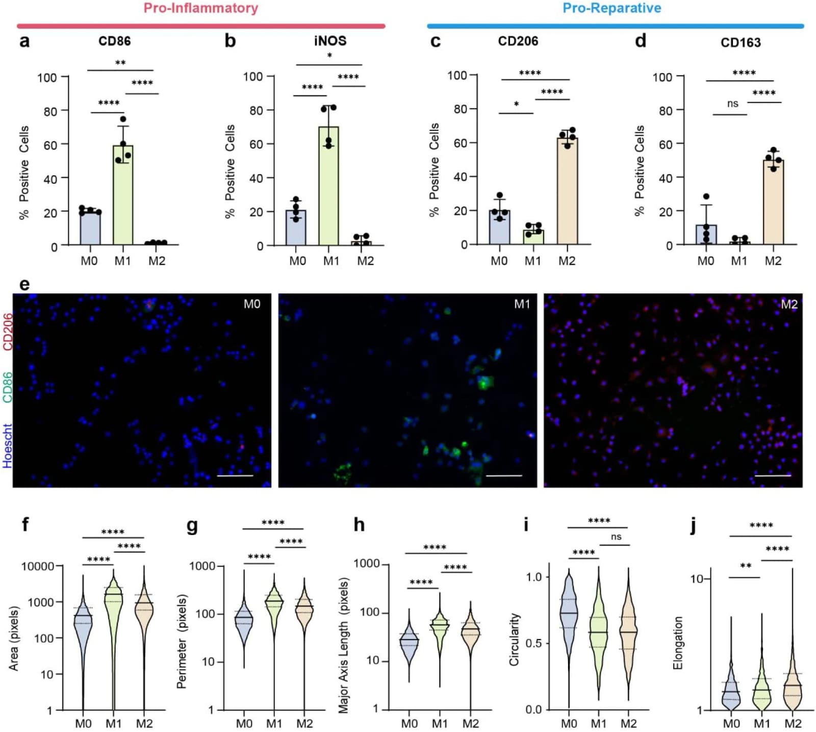 Figure 1. Classically and alternatively activated macrophages show distinct changes to cell morphology.