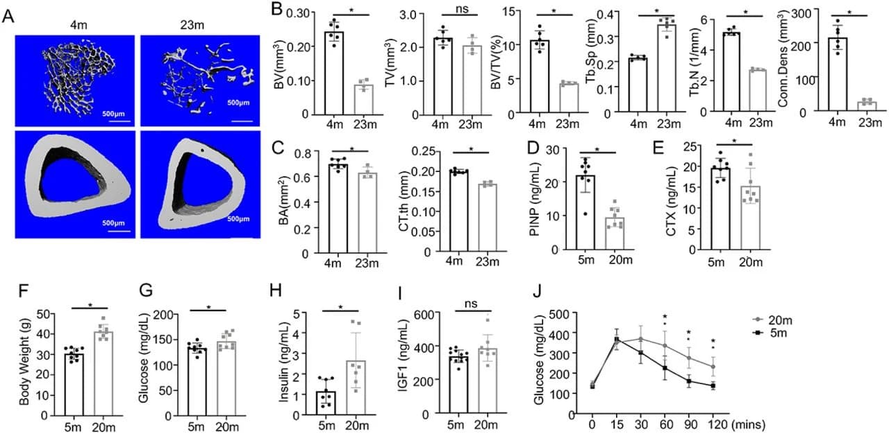 Figure 1. Osteoporosis is associated with impaired glucose metabolism in aged mice.