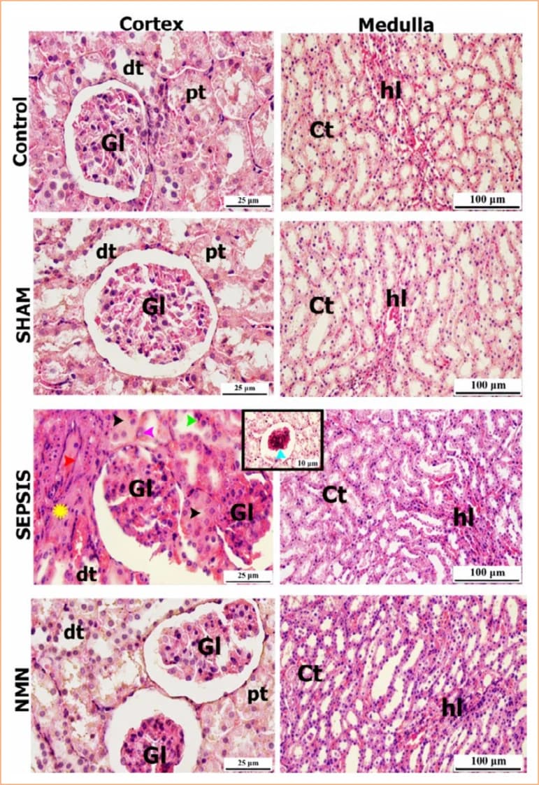 Figure 1. Representative hematoxylin and eosin-stained kidney sections from control, sham, sepsis and sepsis + nicotinamide mononucleotide groups (100× and 400×).
