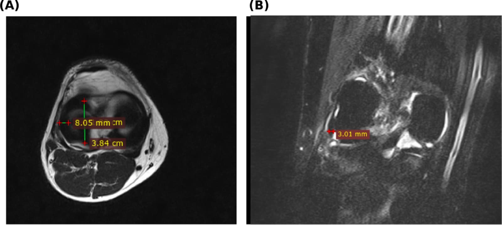 Figure 1 from Surgical and Radiologic Anatomy