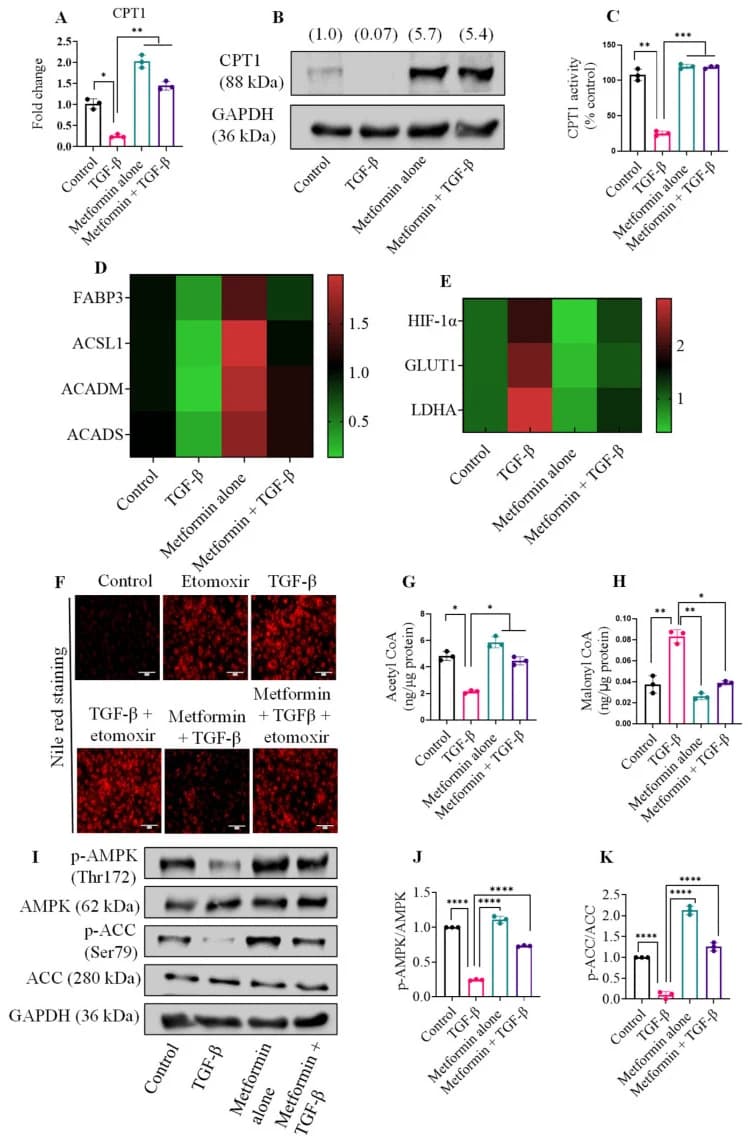 Figure 1. Metformin promotes fatty acid β-oxidation in adult mouse cardiac fibroblasts.