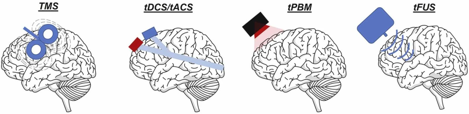 Figure 1 from International Review of Neurobiology