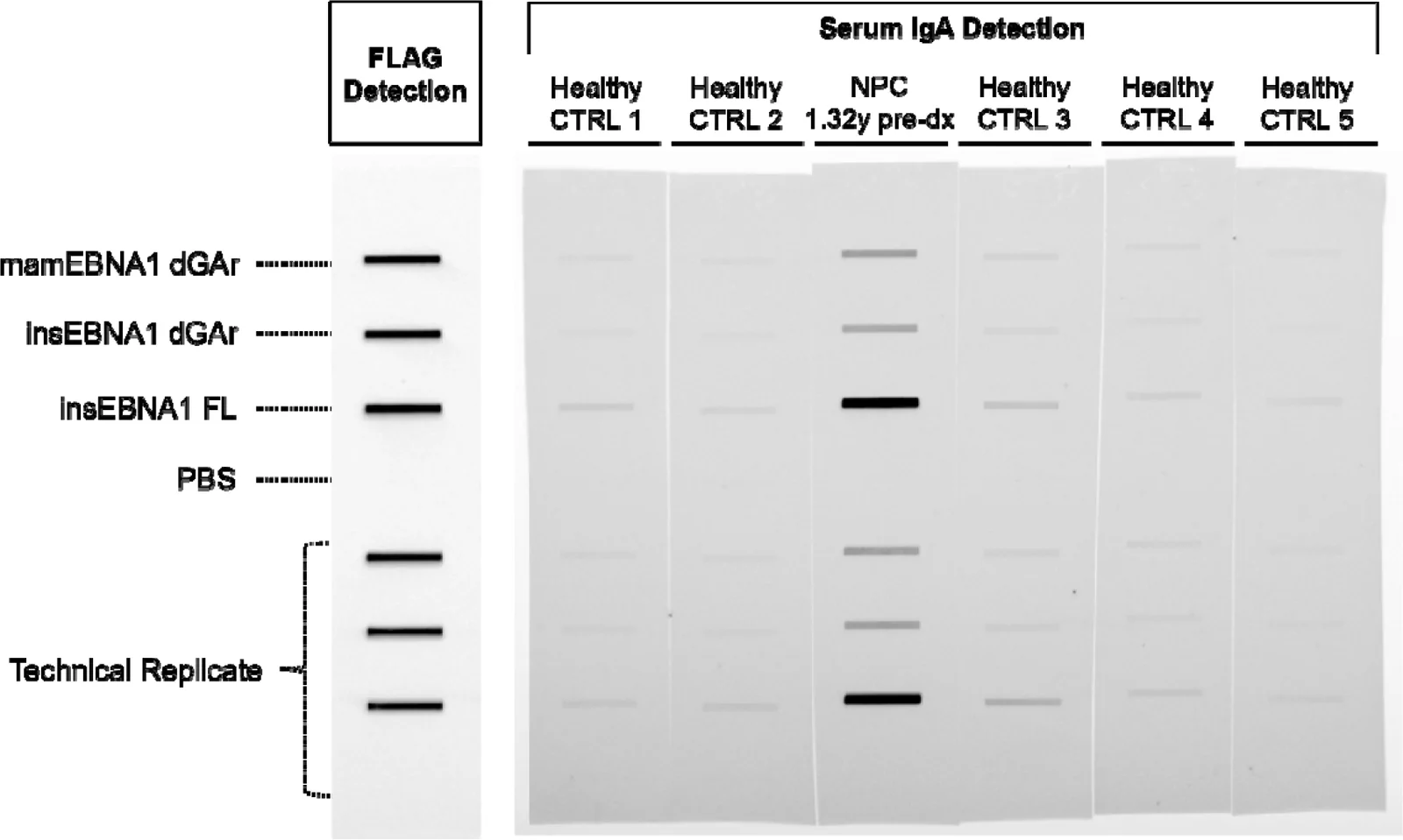 Figure 1. EBNA1 SeroStrip-HT schematic and example of IgA detection.