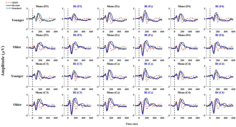 Figure 1. MMN waveforms for younger and older monolinguals and bilinguals in frontal and central electrode locations.