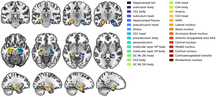 Figure 1. Hippocampal and amygdala subfield segmentations overlaid on MNI152 template brain, shown in representative coronal, axial, and sagittal slices to illustrate hippocampus–amygdala subfield anatomy.