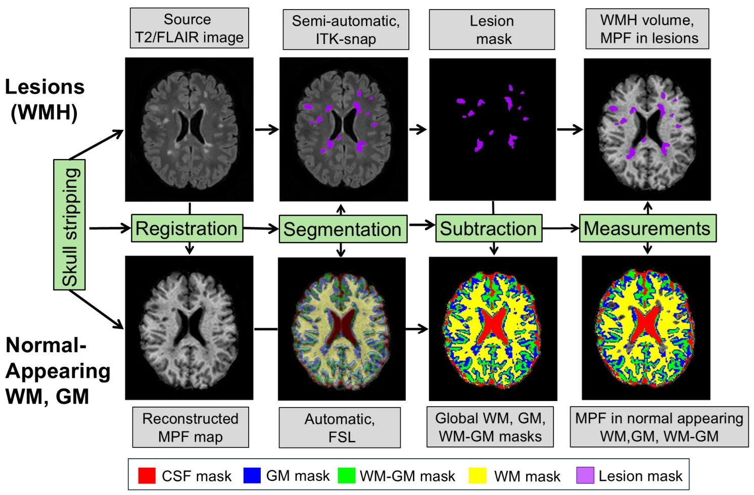 Figure 1. Scheme of the image processing pipeline (in the figure: patient with MS, female, 35 years old): skull stripping, registration, segmentation, subtraction, and measurements.
