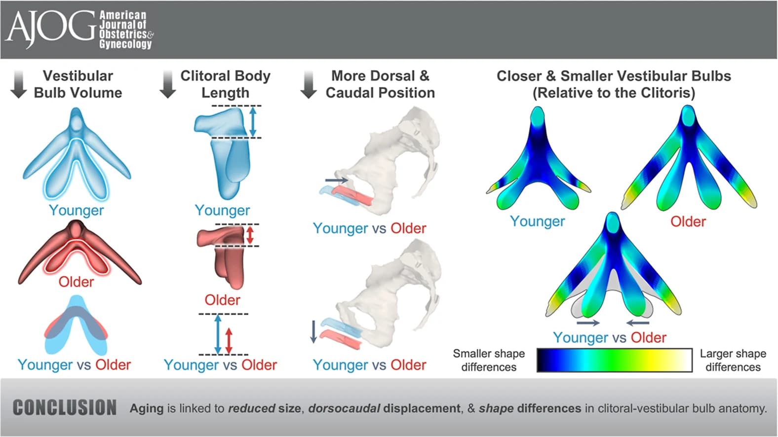 Graphical abstract from American Journal of Obstetrics and Gynecology