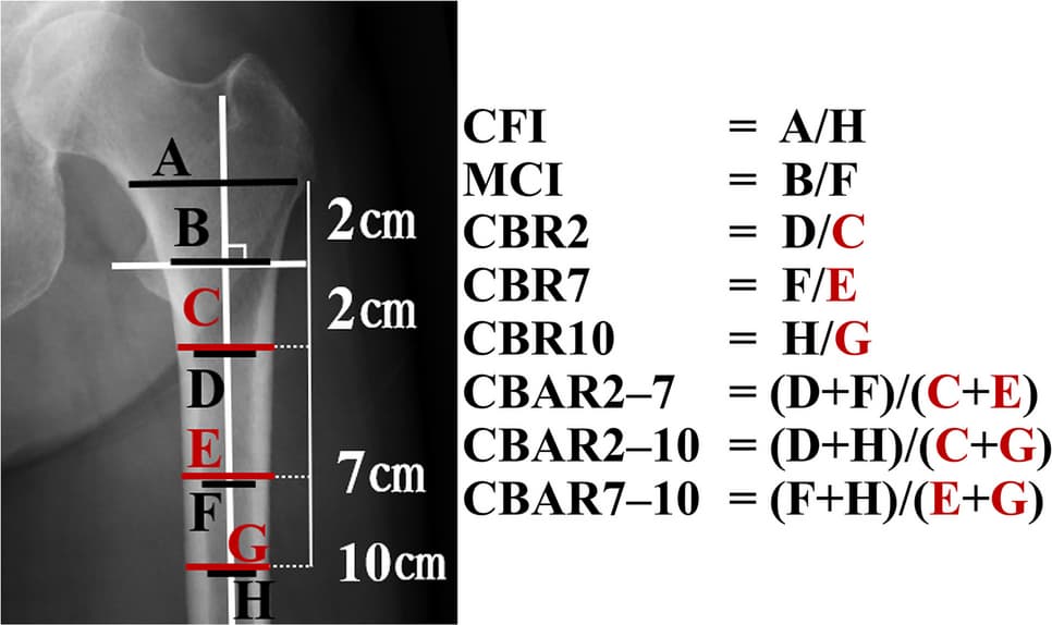 Figure 1 from Archives of Osteoporosis