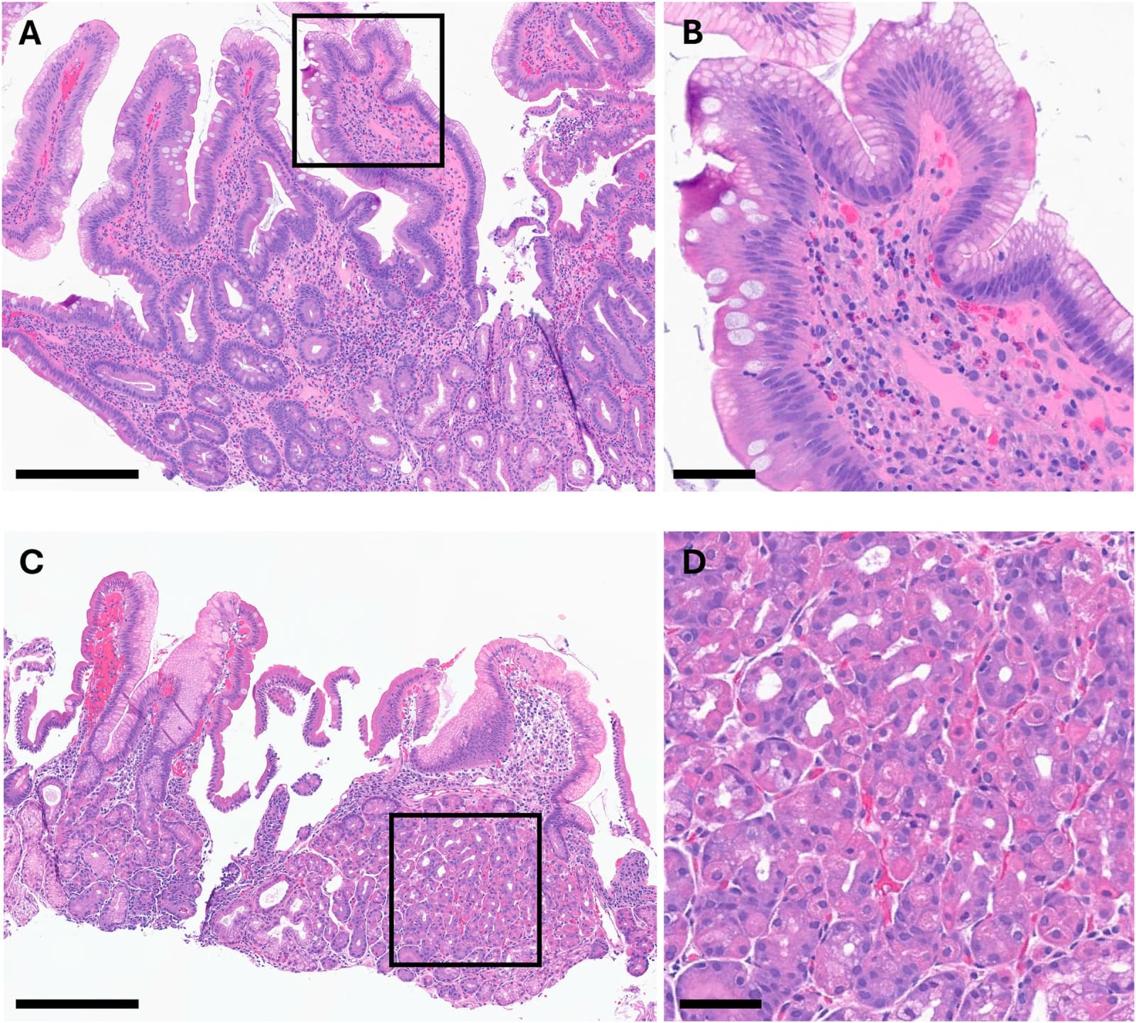 Figure 1 from Human Pathology