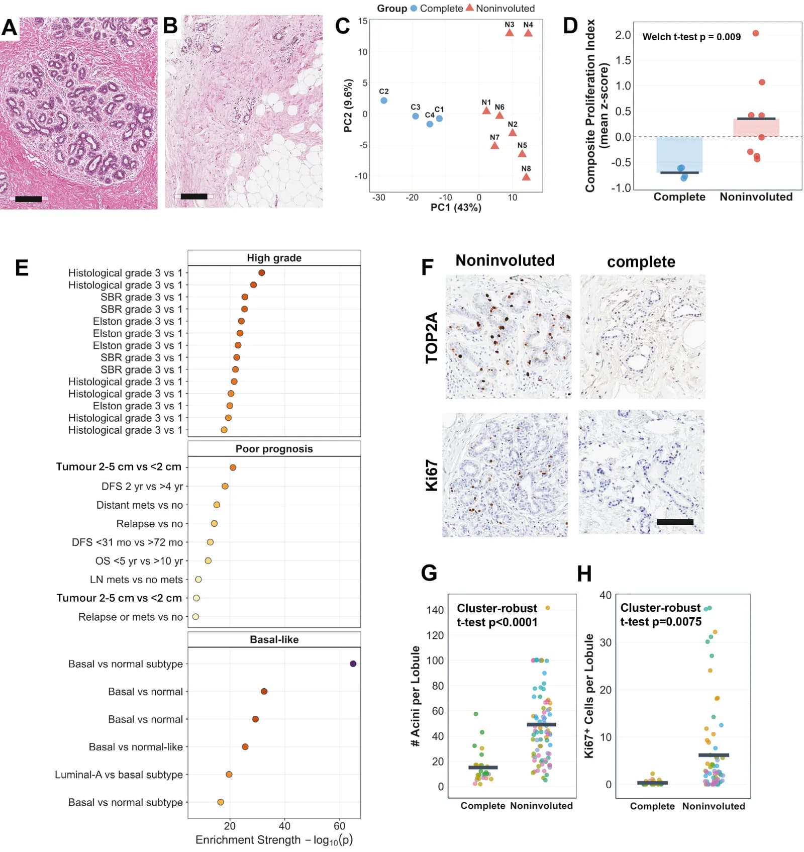 Fig. 1. Breast tissue that stalls at the menopausal transition retains a proliferation-competent epithelial state with tumour-associated gene expression.