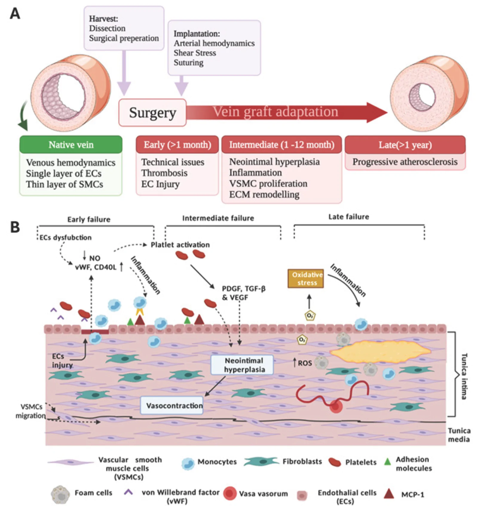 Figure 1. Stages and mechanisms of vein graft adaptation and failure (A) Overview of saphenous vein graft adaptation after arterial implantation, showing the transition from normal venous structure to early…