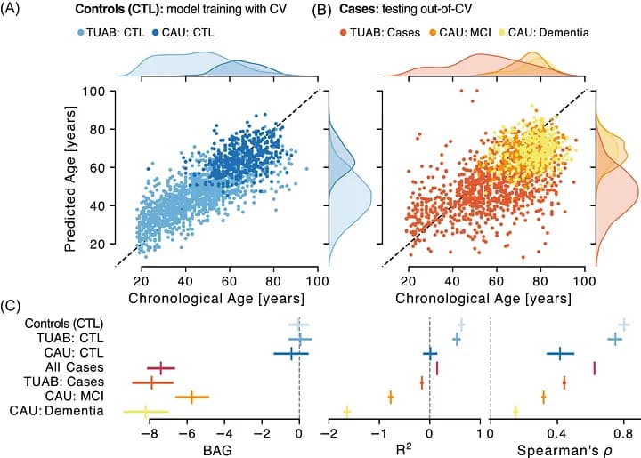 Figure 1. Brain‐age models derived from EEG power spectra of controls predicted younger age in clinical cohorts.
