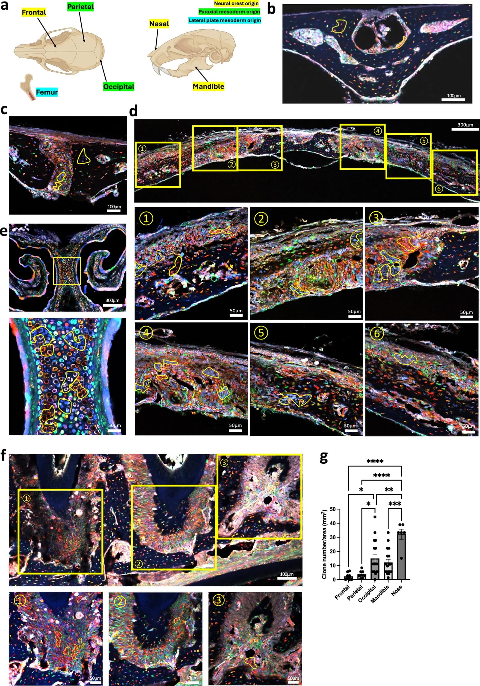 Fig. 1. Lineage tracing with ActinCreER;R26VT2/GK3 mice revealed clonally expanded cells in cranial bones.