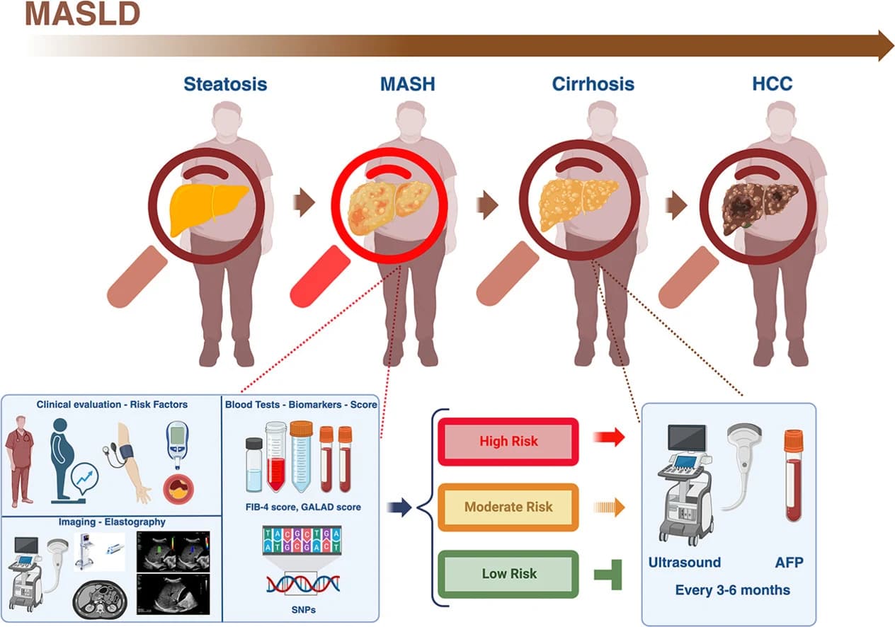 Graphical abstract from Annals of Hepatology