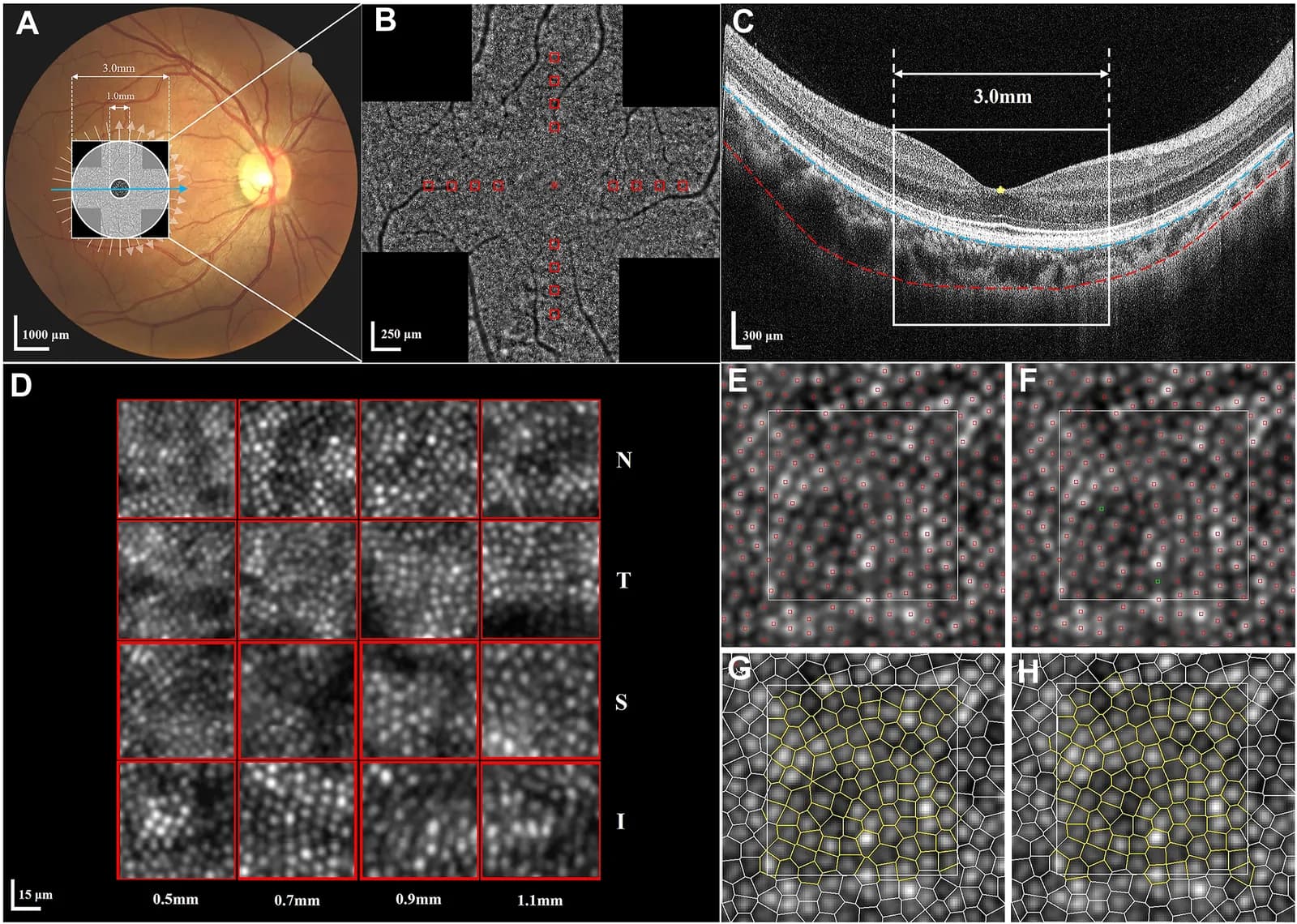 Figure 1. Imaging with AO Fundus Camera and OCT.
