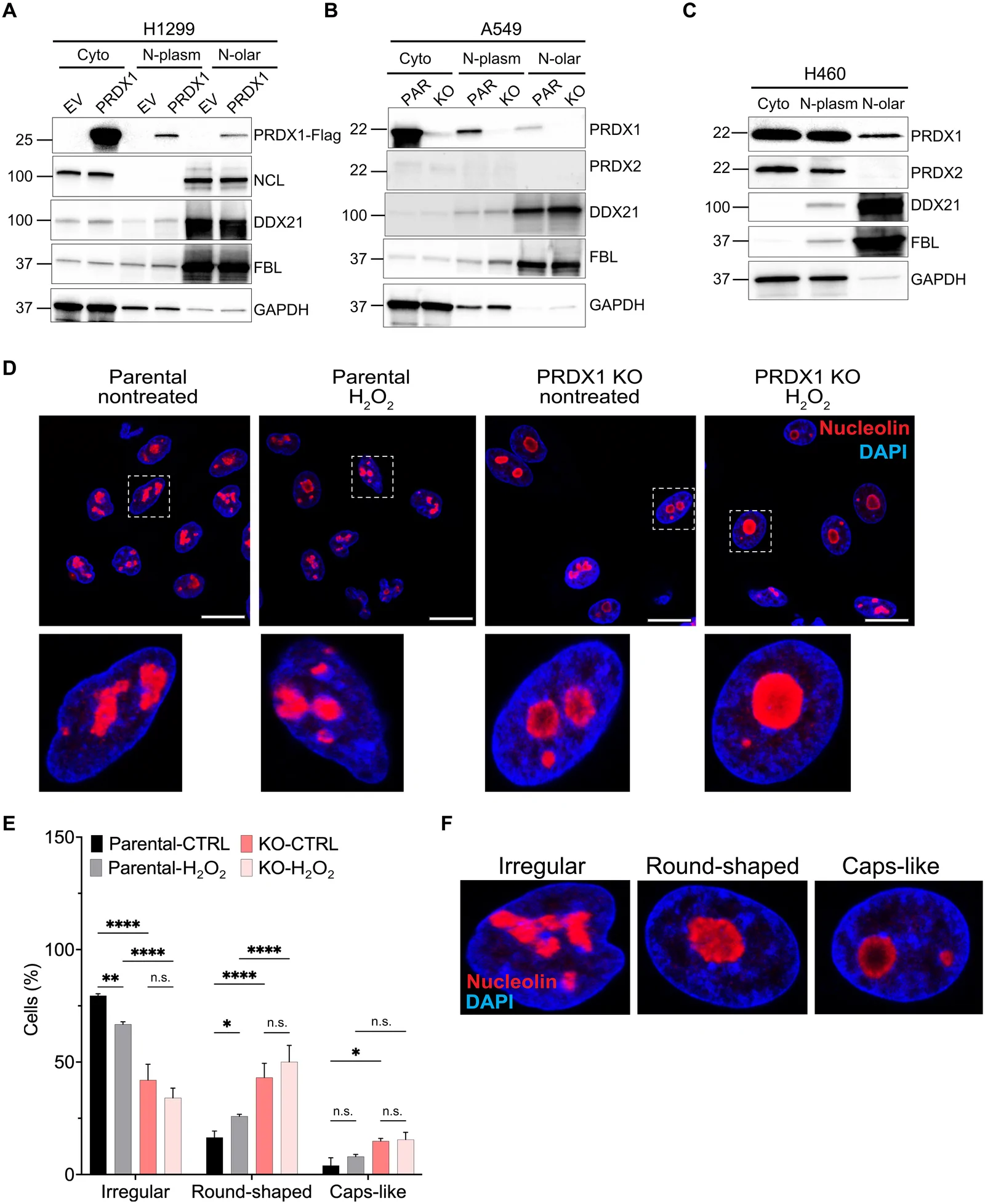 Fig. 1. Loss of PRDX1 induces nucleolar abnormalities.
