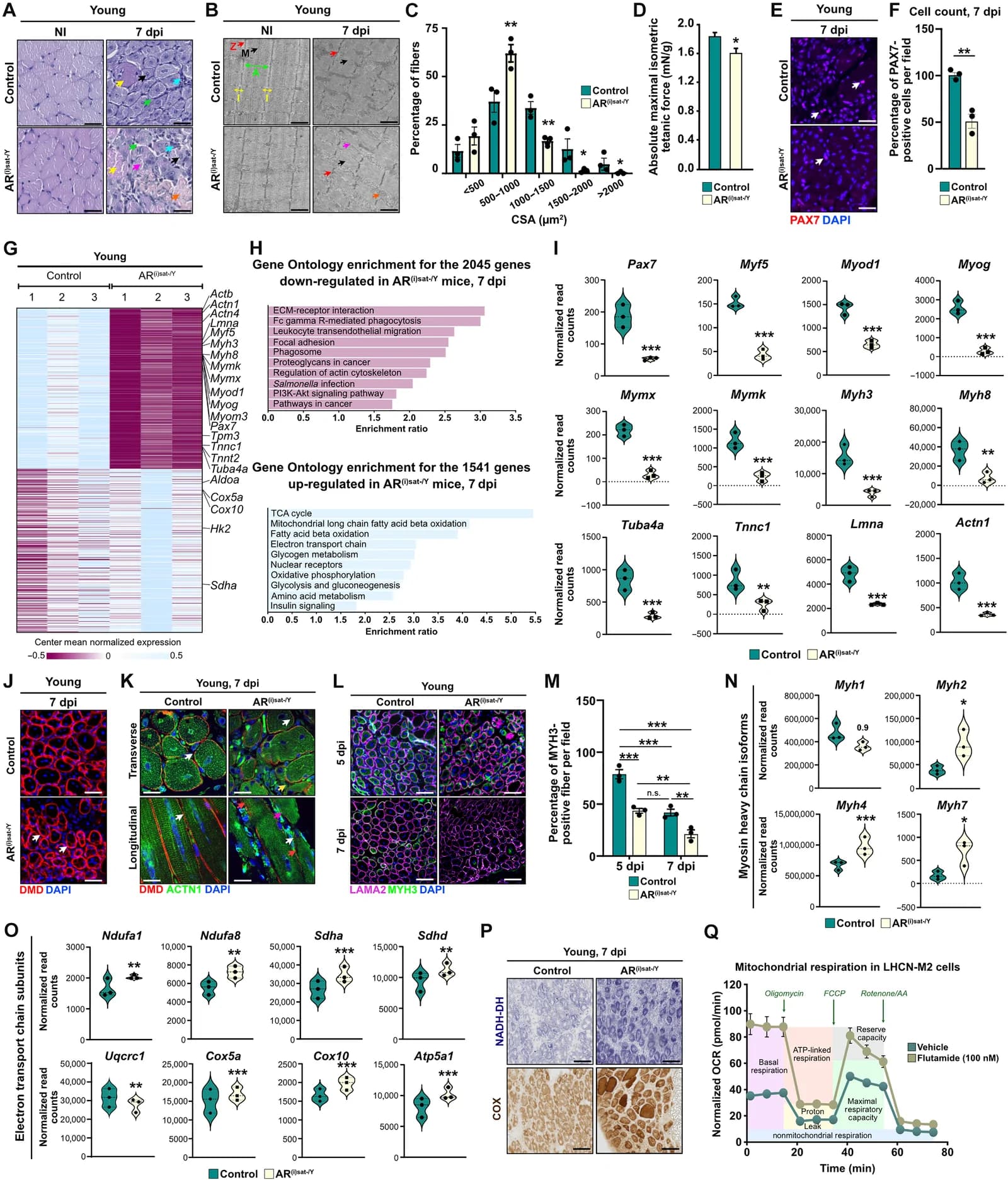 Fig. 1. Absence of MuSC-AR impairs muscle regenerative capacities at young age.