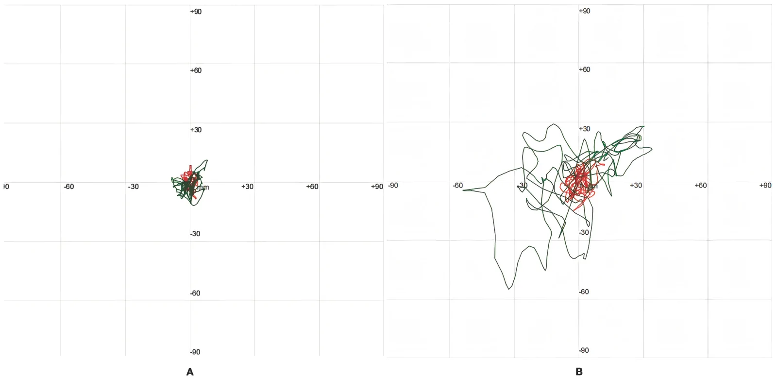 Figure 1. Representative trajectories of the patient’s center of pressure.