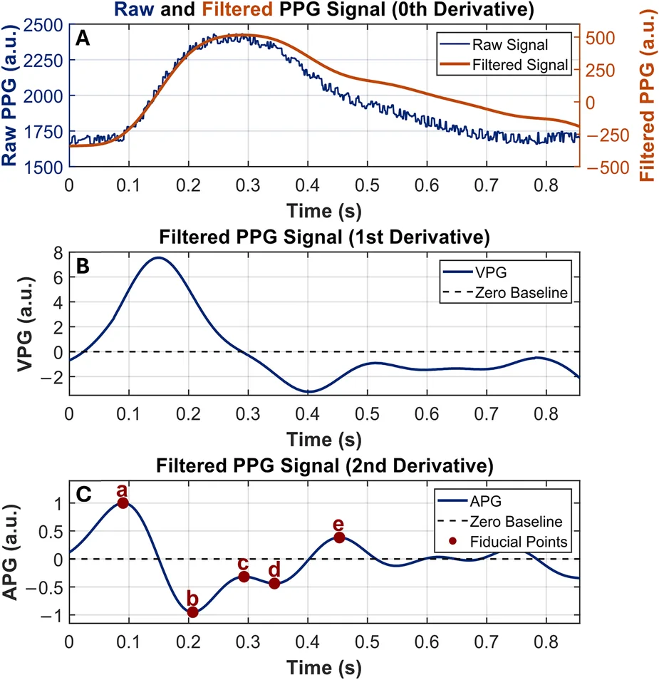 Figure 1. PPG signal processing and identification of APG fiducial points.