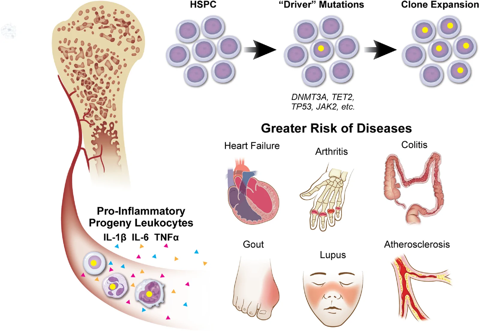 Figure 1. Clonal haematopoiesis promotes systemic inflammation and increases the risk of immune-mediated diseases.