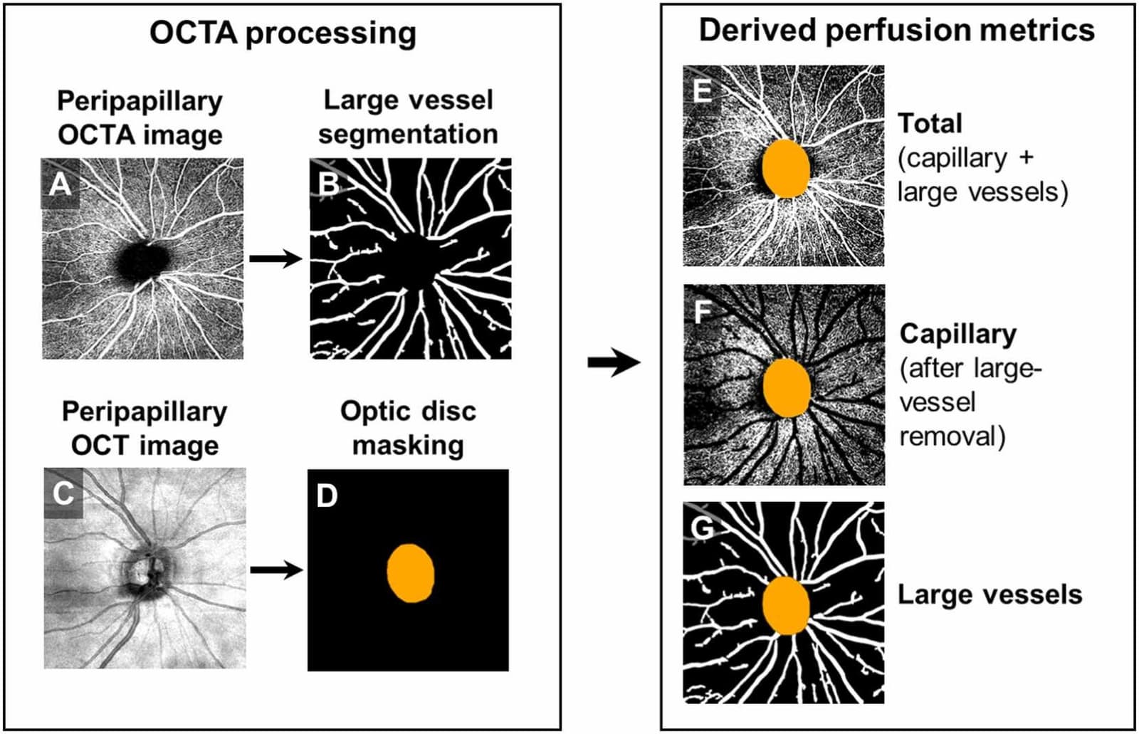 Figure 1 from Asia-Pacific Journal of Ophthalmology