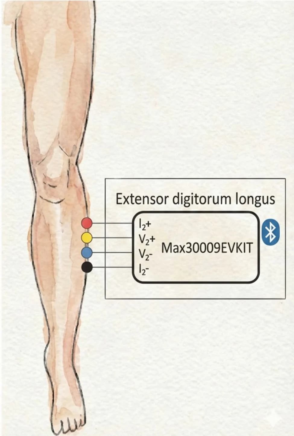 Fig. 1. Schematic representation of the tetrapolar EBI sensor configuration.