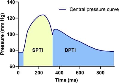The measurement method of subendocardial viability ratio (SEVR).