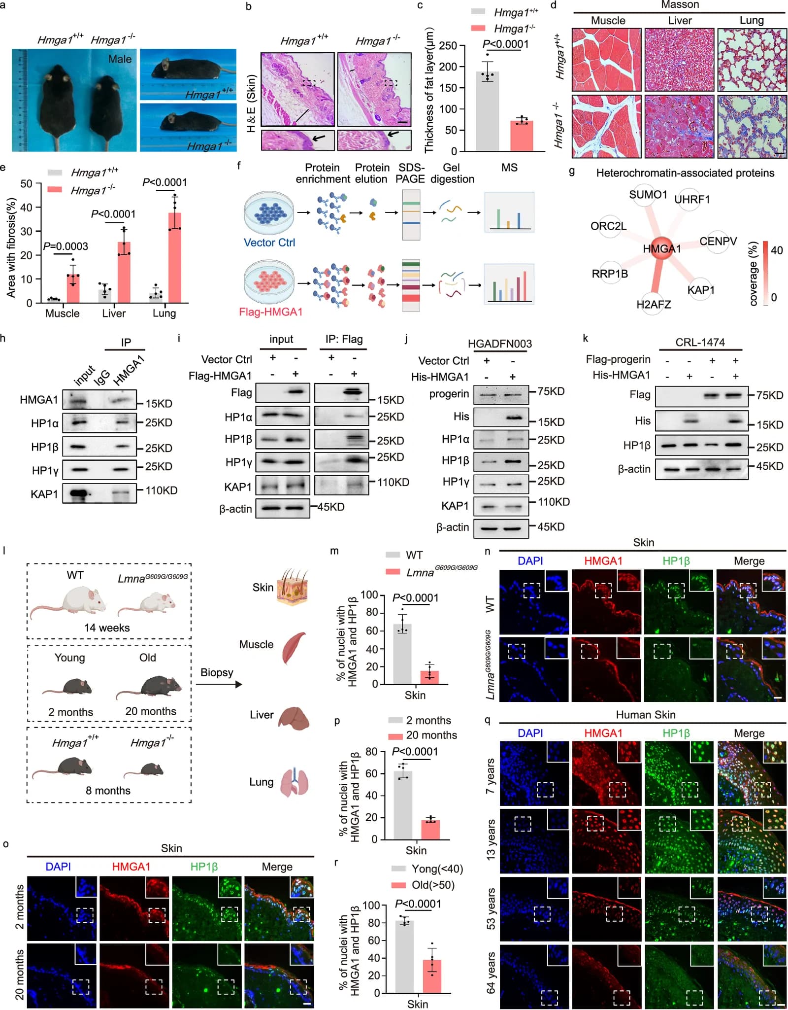 Fig. 1. HMGA1 positively regulates HP1β in both HGPS and natural aging.