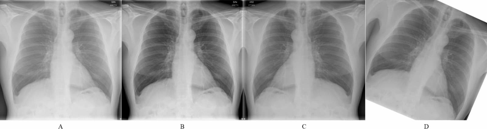 Figure 1 from La Radiologia Medica