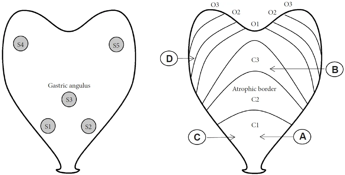 Fig. 1. Obtaining gastric biopsy samples for diagnostic purposes.