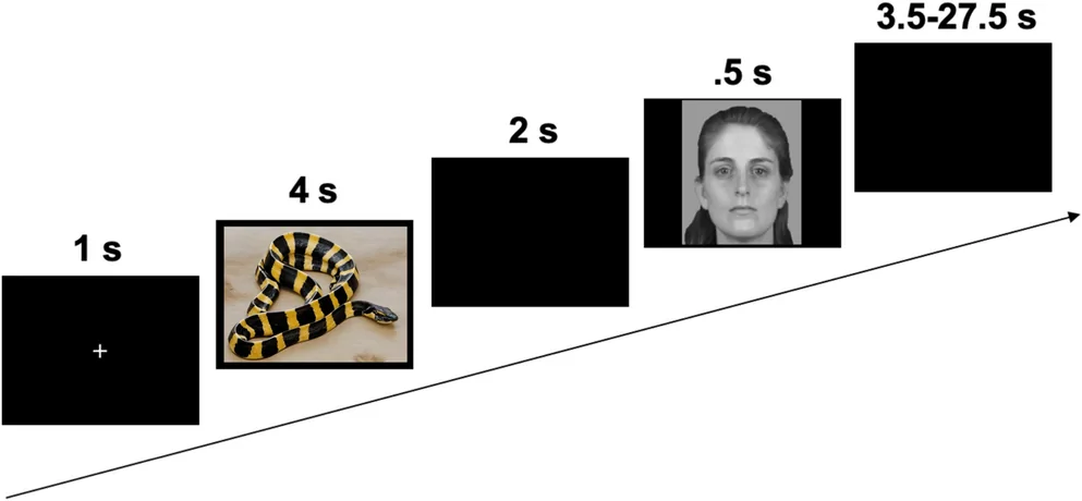 Fig. 1. fMRI Trial Structure: On each trial, participants viewed either a negative, neutral, or positive image from the International Affective Picture System for 4 s.