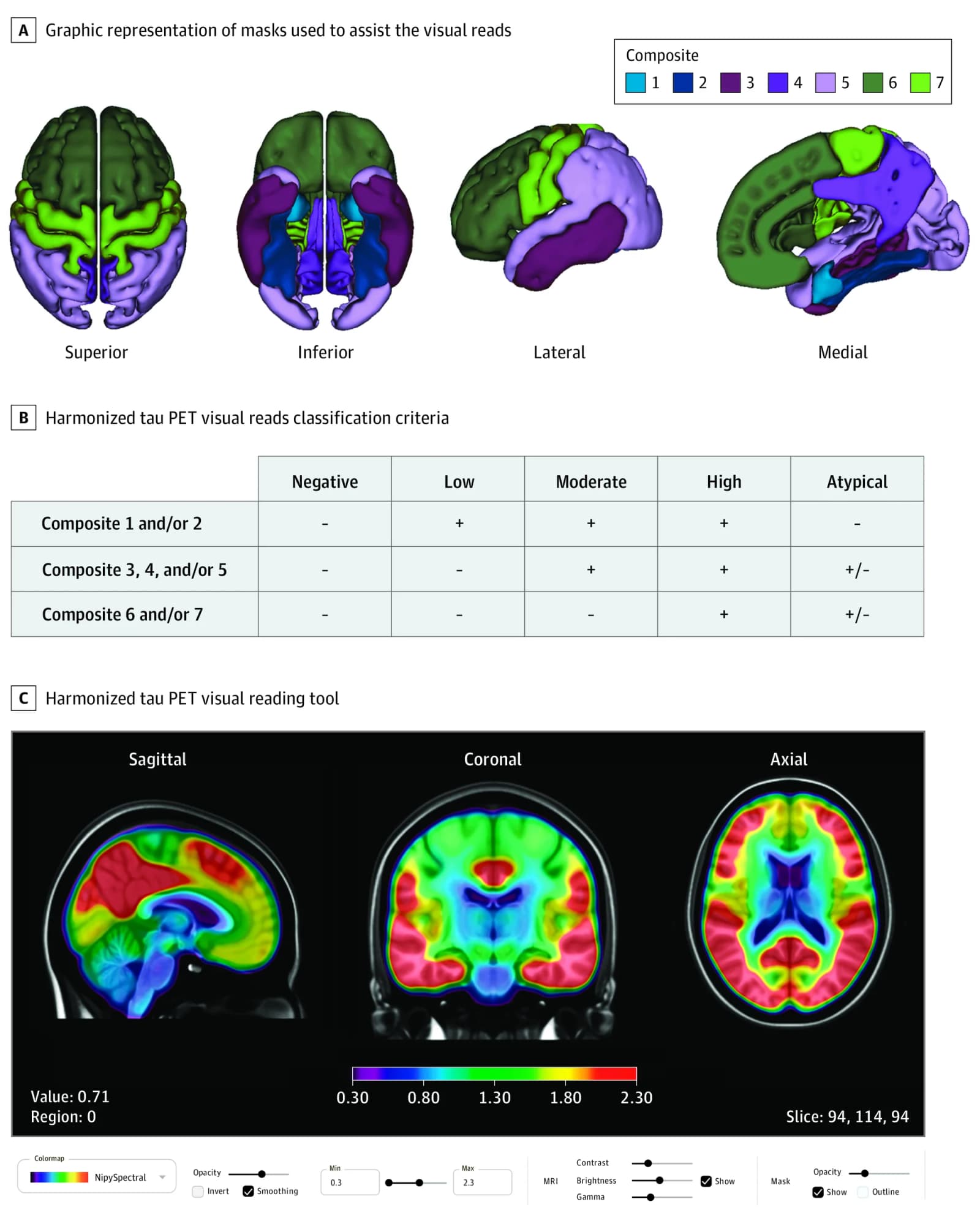 Figure 1. Visualization of Brain Regions, Classification Schematic, and Reading Tool Showing Harmonized Framework for Tau Positron Emission Tomography (PET) Visual Reading and Classification.
