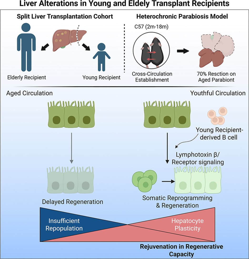 Graphical abstract from Journal of Hepatology
