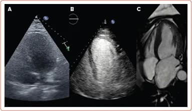 Figure 1. Echocardiographic and Cardiac MRI Image Quality