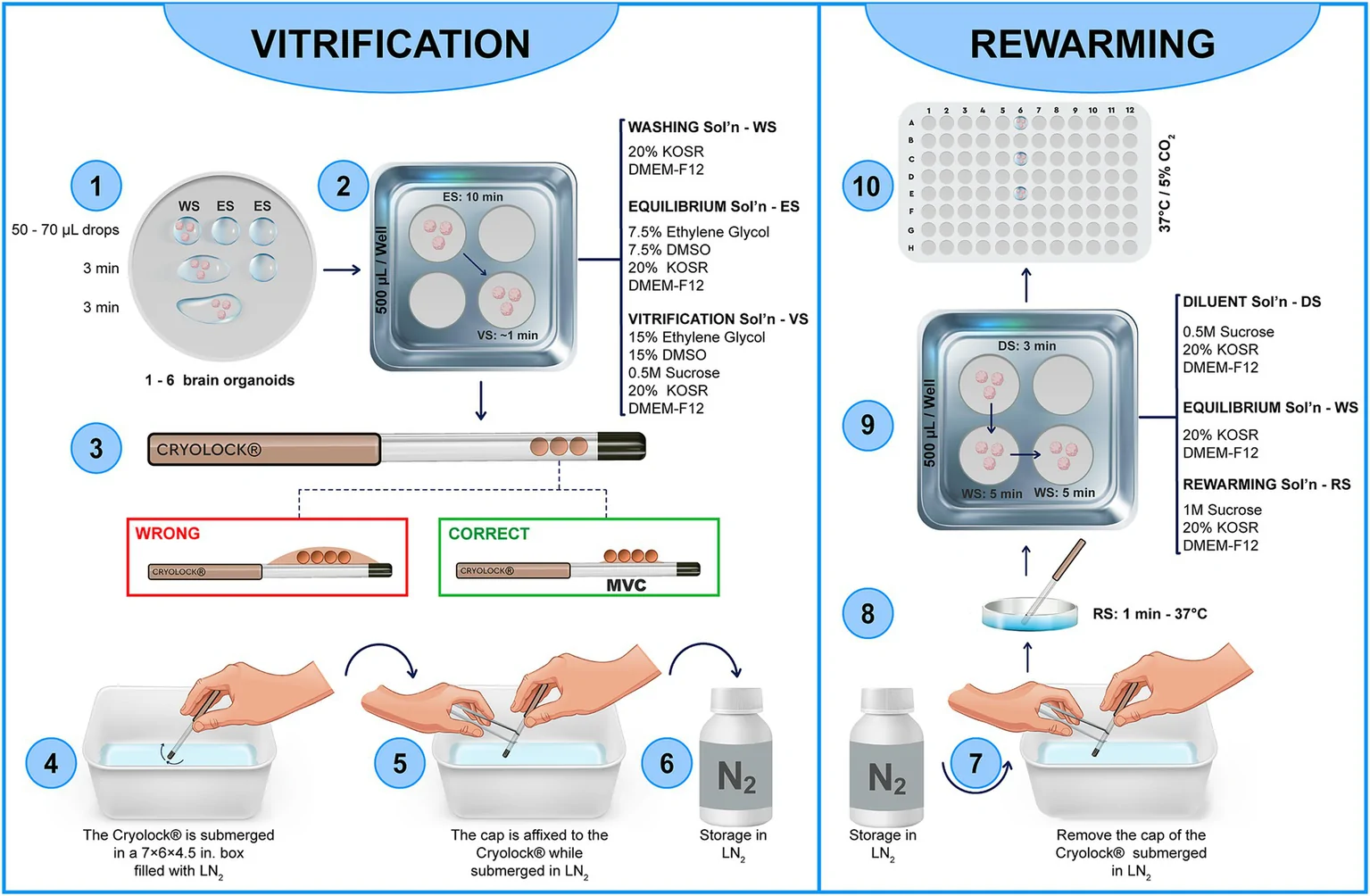 Figure 1. Overview of the vitrification protocol.