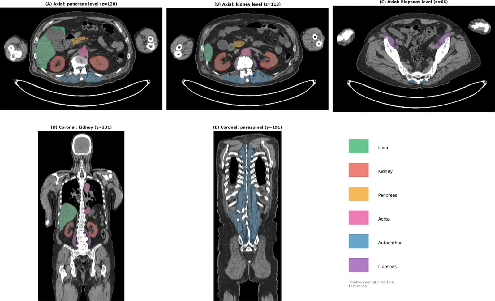 Figure 1 from Japanese Journal of Radiology