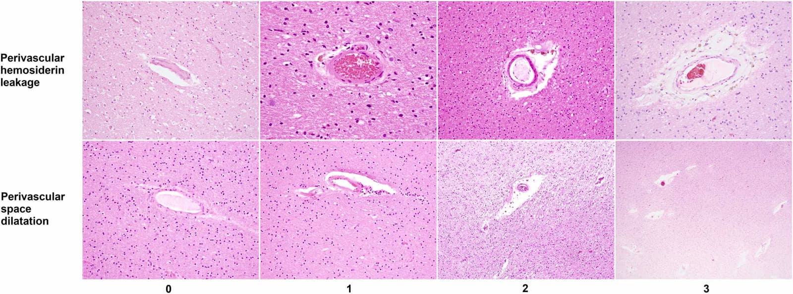 Figure 1 from Neurobiology of Aging