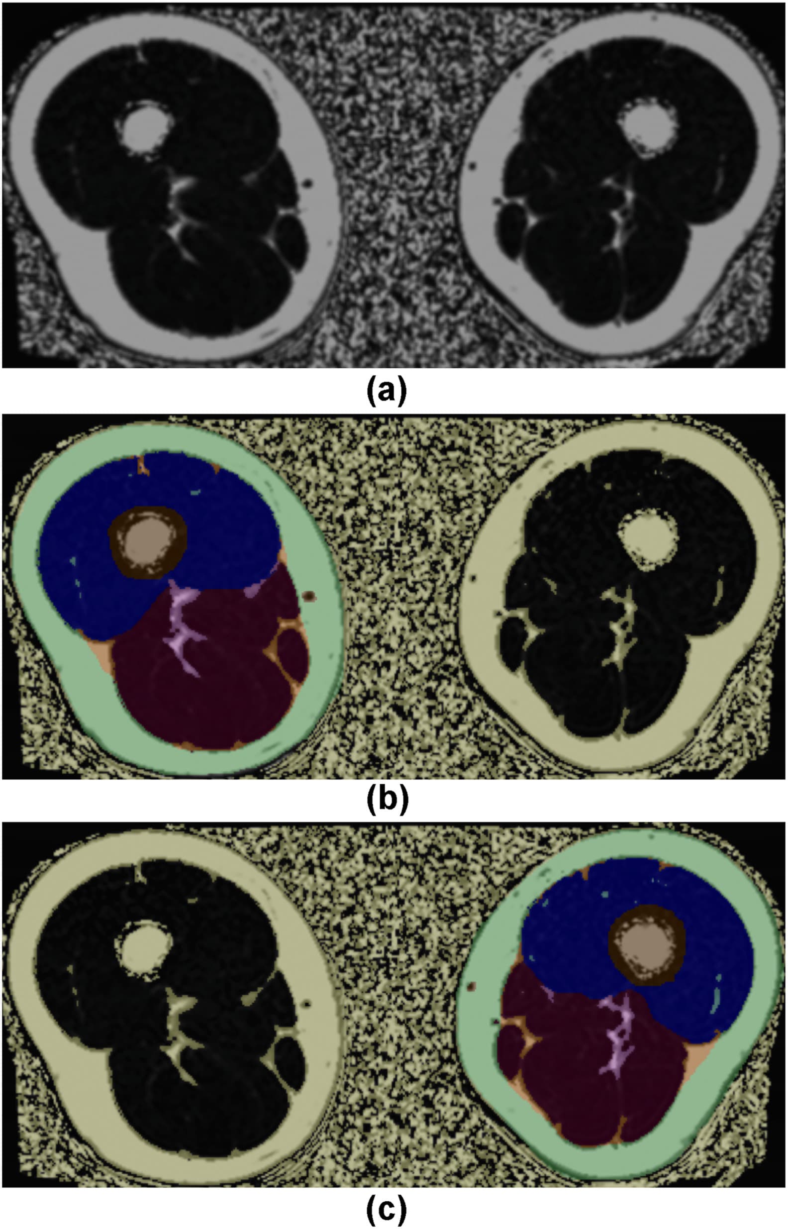 Figure 1 from Clinical Radiology
