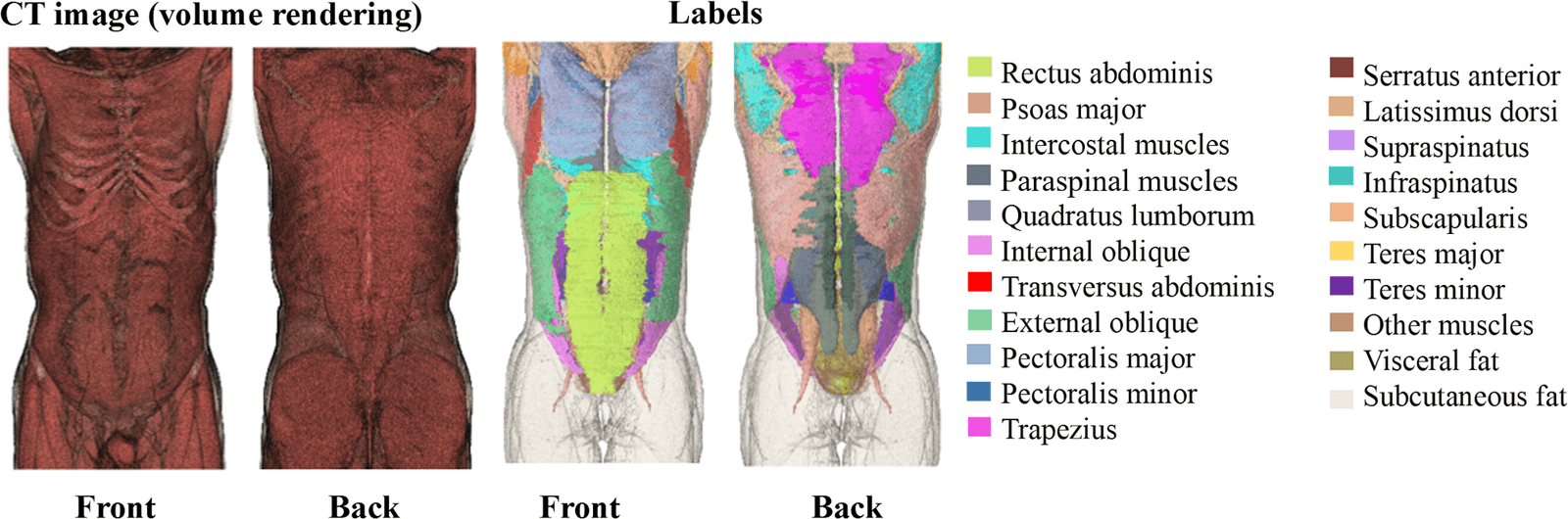 Figure 1 from International Journal of Computer Assisted Radiology and Surgery