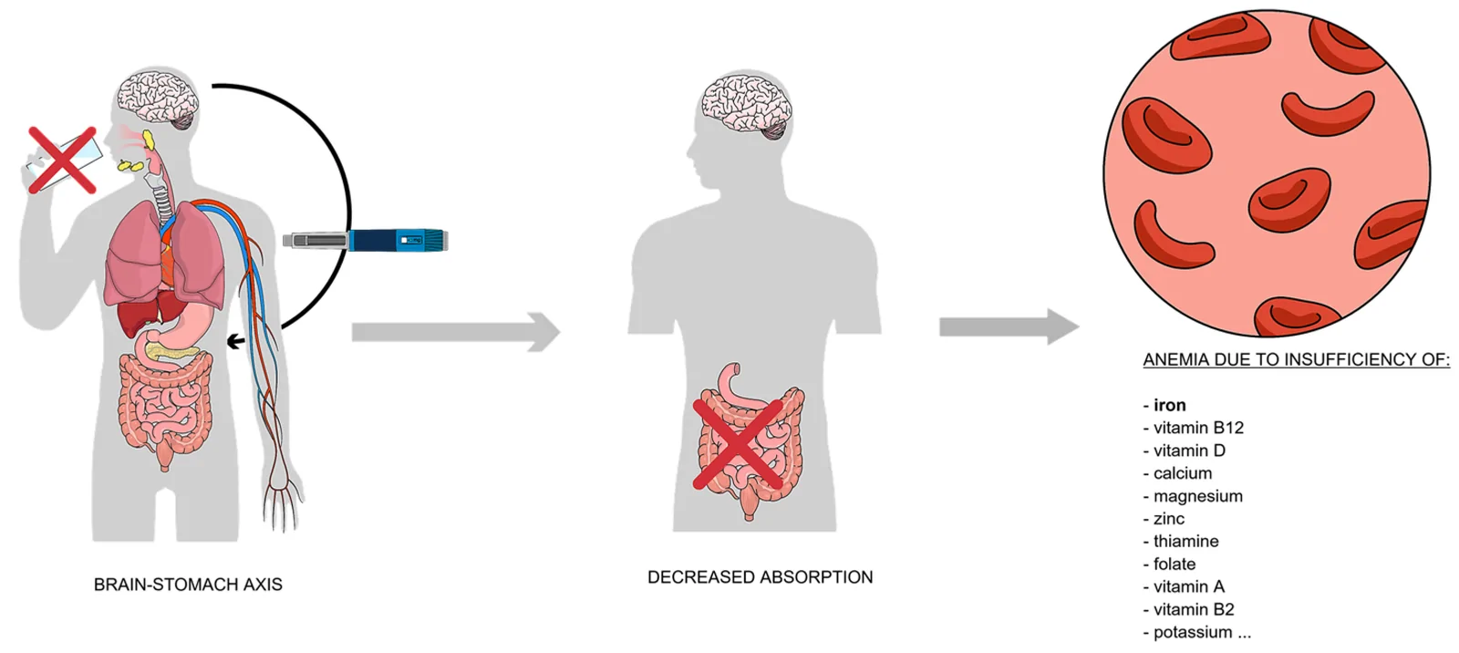 Figure 1. Proposed pathways that may contribute to hematological and nutritional changes during incretin-based therapy.