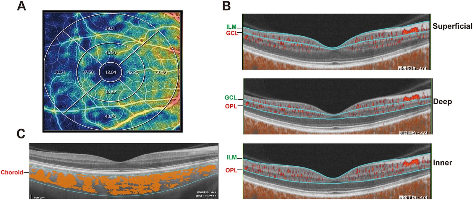 Figure 1 from Experimental Eye Research
