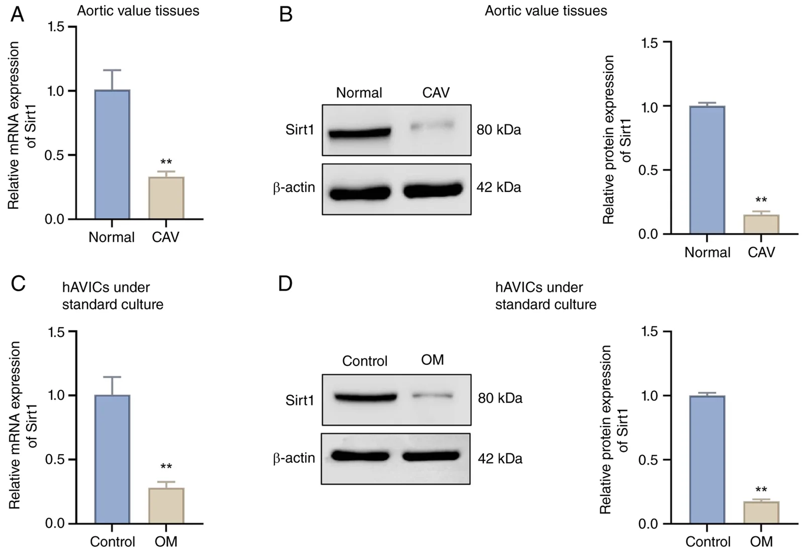 Figure 1. Downregulation of Sirt1 in calcified aortic valve tissues and osteogenic-induced aortic valve interstitial cells.