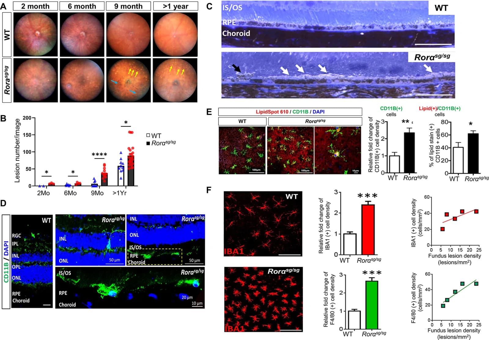 Fig. 1. Aging Rorasg/sg mice developed AMD-like pathologies with fundus lesions and accumulation of lipid-enriched macrophages in the subretinal space.