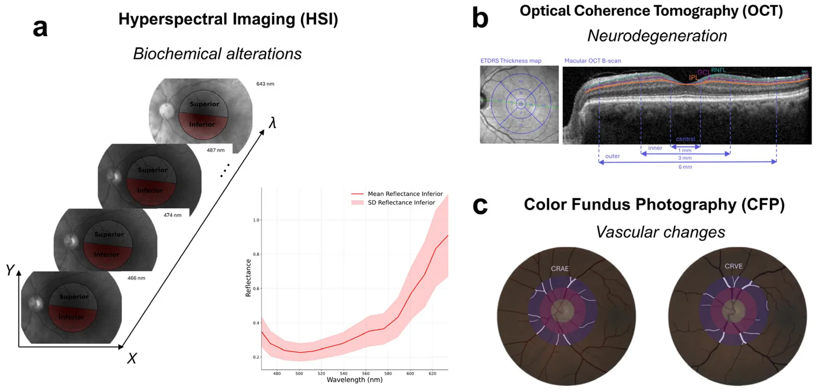 Figure 1. Multimodal retinal images from a cognitively normal, Aβ− subject.