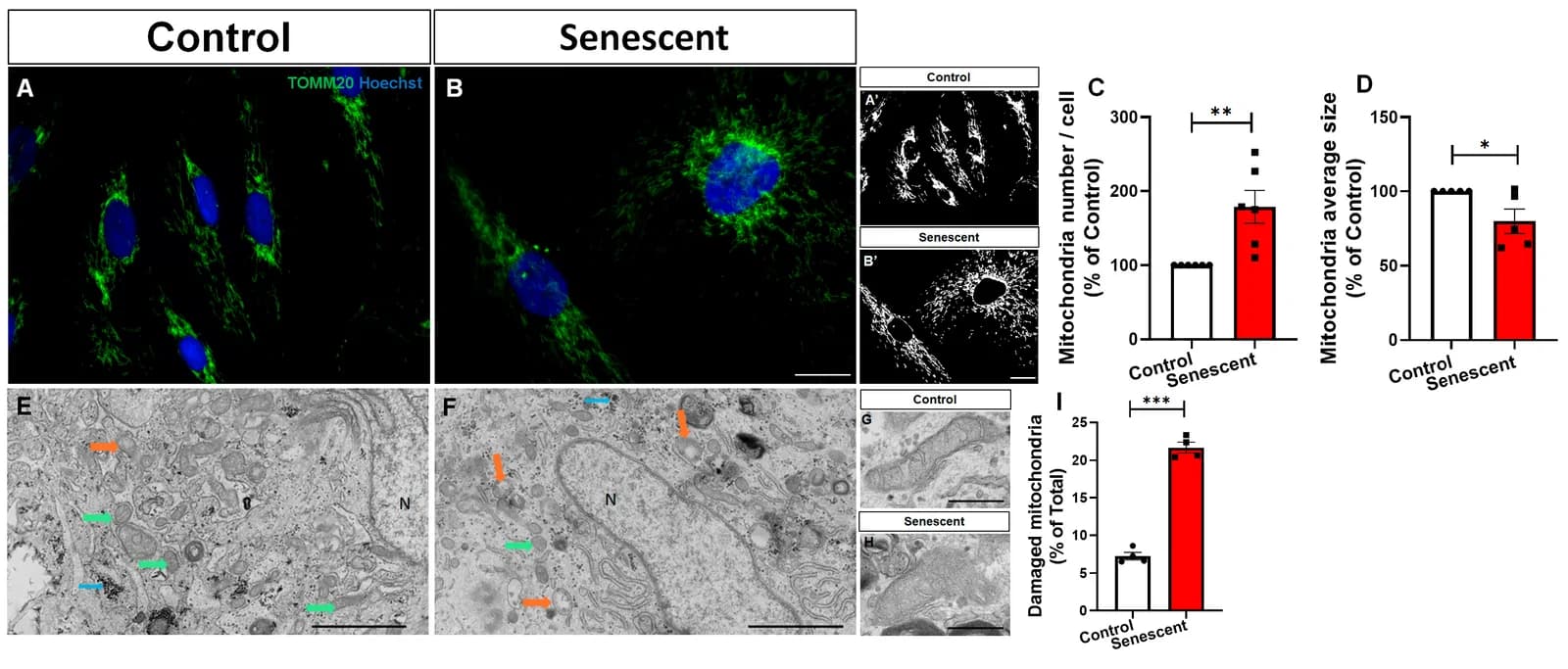 Figure 1. Senescent human astrocytes exhibit mitochondrial fragmentation and ultrastructural damage.