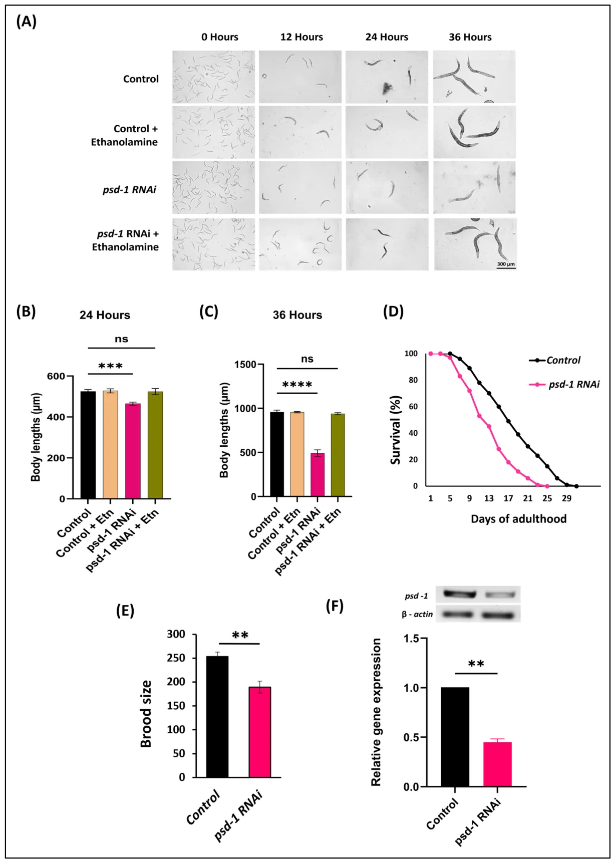 Figure 1. (A) Comparative images of C. elegans reveal a developmental delay in psd-1 knockdown animals relative to control worms fed with HT115 (EV, empty vector) rescued by ethanolamine supplementation.