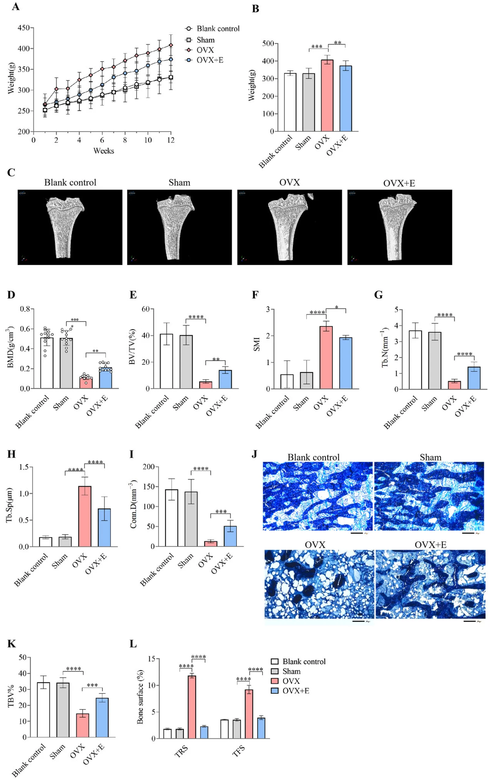 Figure 1. Estrogen mitigates bone density loss and improves bone microarchitecture in OVX rats.