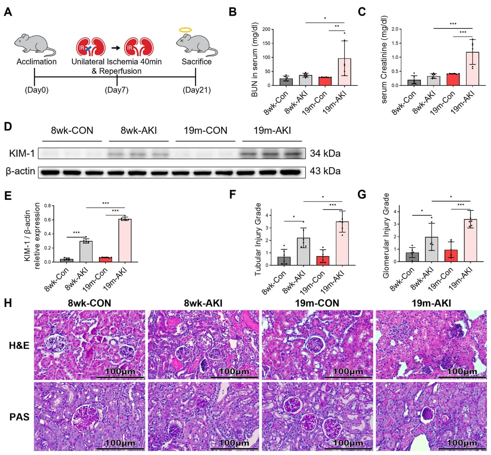 Figure 1. Exacerbation of ischemia–reperfusion (I/R)-induced renal injury in aged mice compared to young mice.