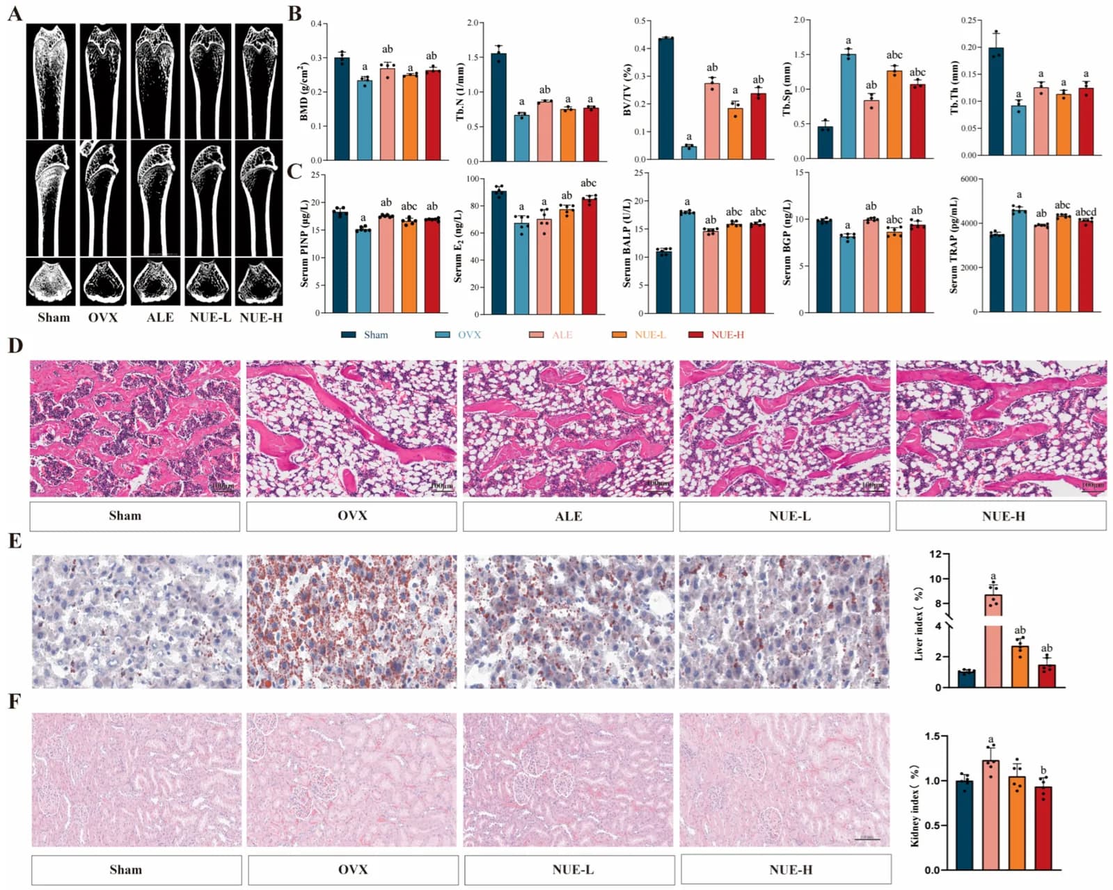 Effects of Nue on bone microarchitecture, serum biomarkers, and tissue histology in OVX rats.